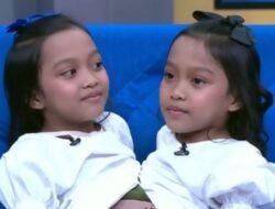 Ai Putri Dewi Ningsih dan Ai Putri Anugrah Kembar Siam dari Garut